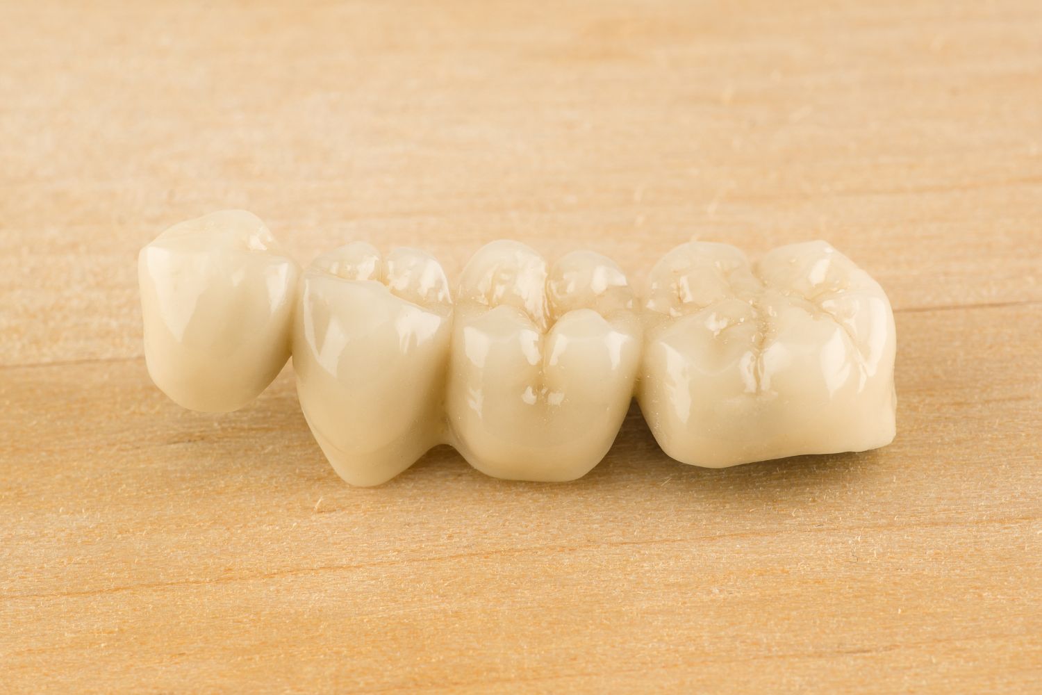 Cemento dental definitivo para la fijación de puentes y coronas